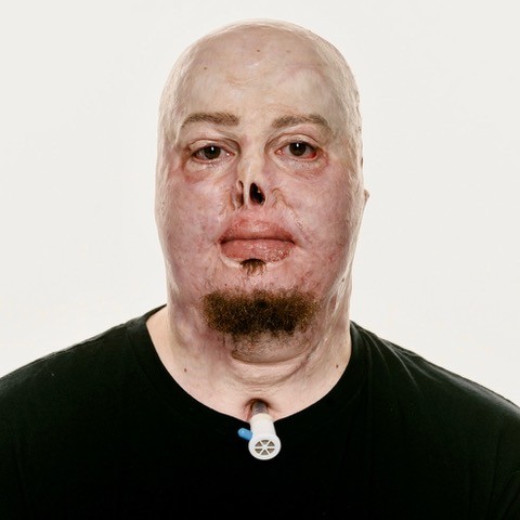 Images by photographer Giles Duley.